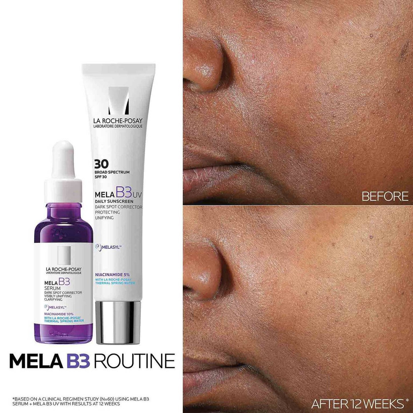 mela-b3-dark-spot-serum-and-mela-b3-uv-daily-moisturizer-with-spf-30-d6 3-Mela-B3-routine_1500X1500.jpg