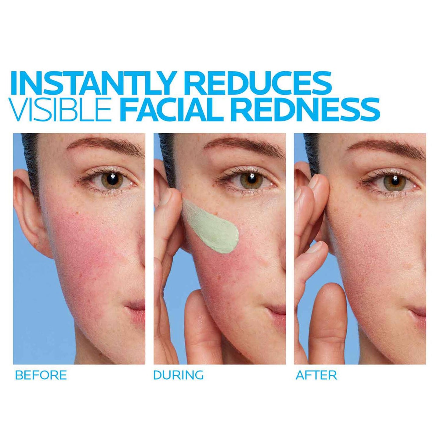 toleriane-rosaliac-ar-face-cream-for-visible-redness-i9 8_Toleriane_Rosaliac-AR-before-after.jpg