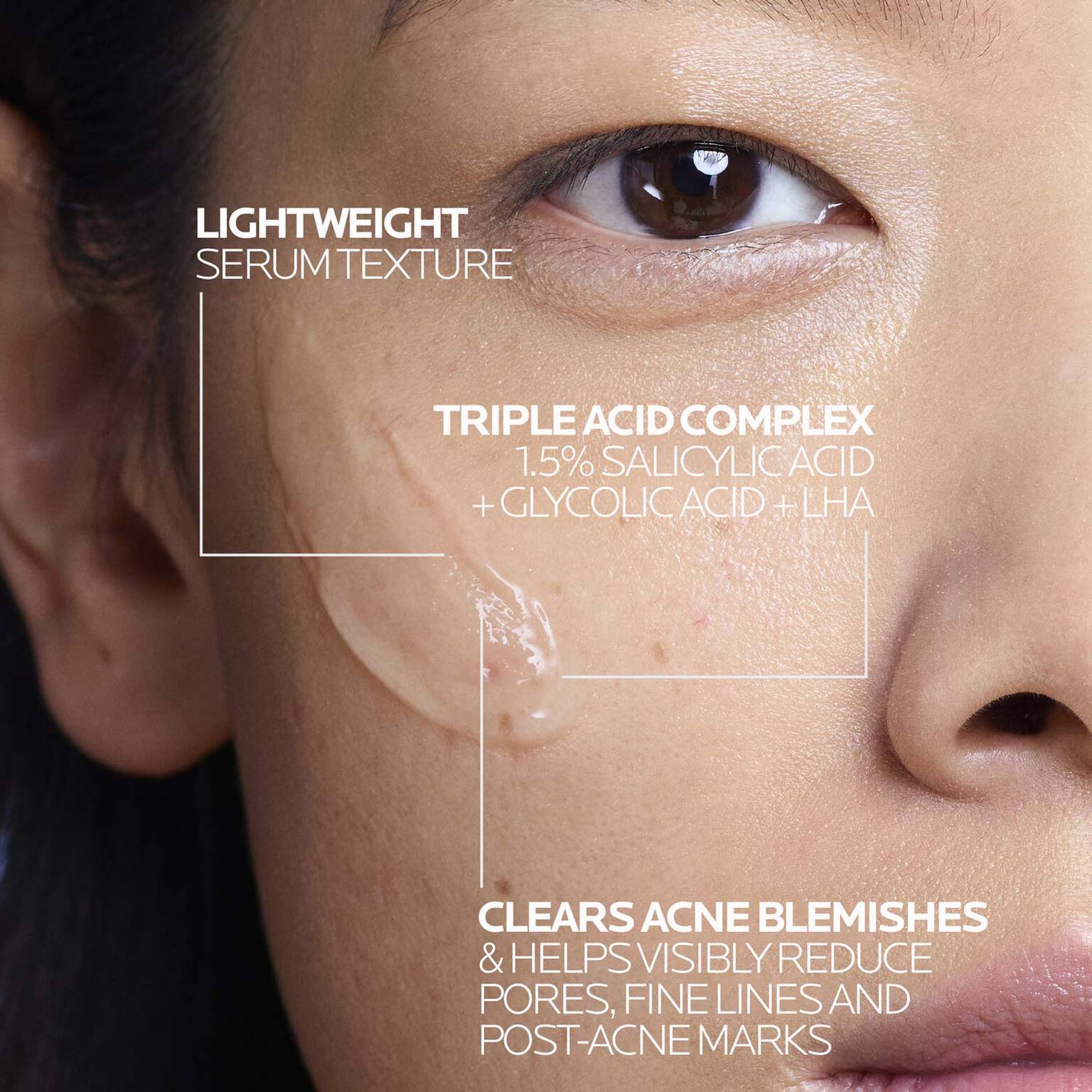 effaclar-salicylic-acid-acne-treatment-serum-m8 LaRochePosay-Product-Effaclar-Effaclar-Serum-30ml-3337875722827-Texture-REV.jpg