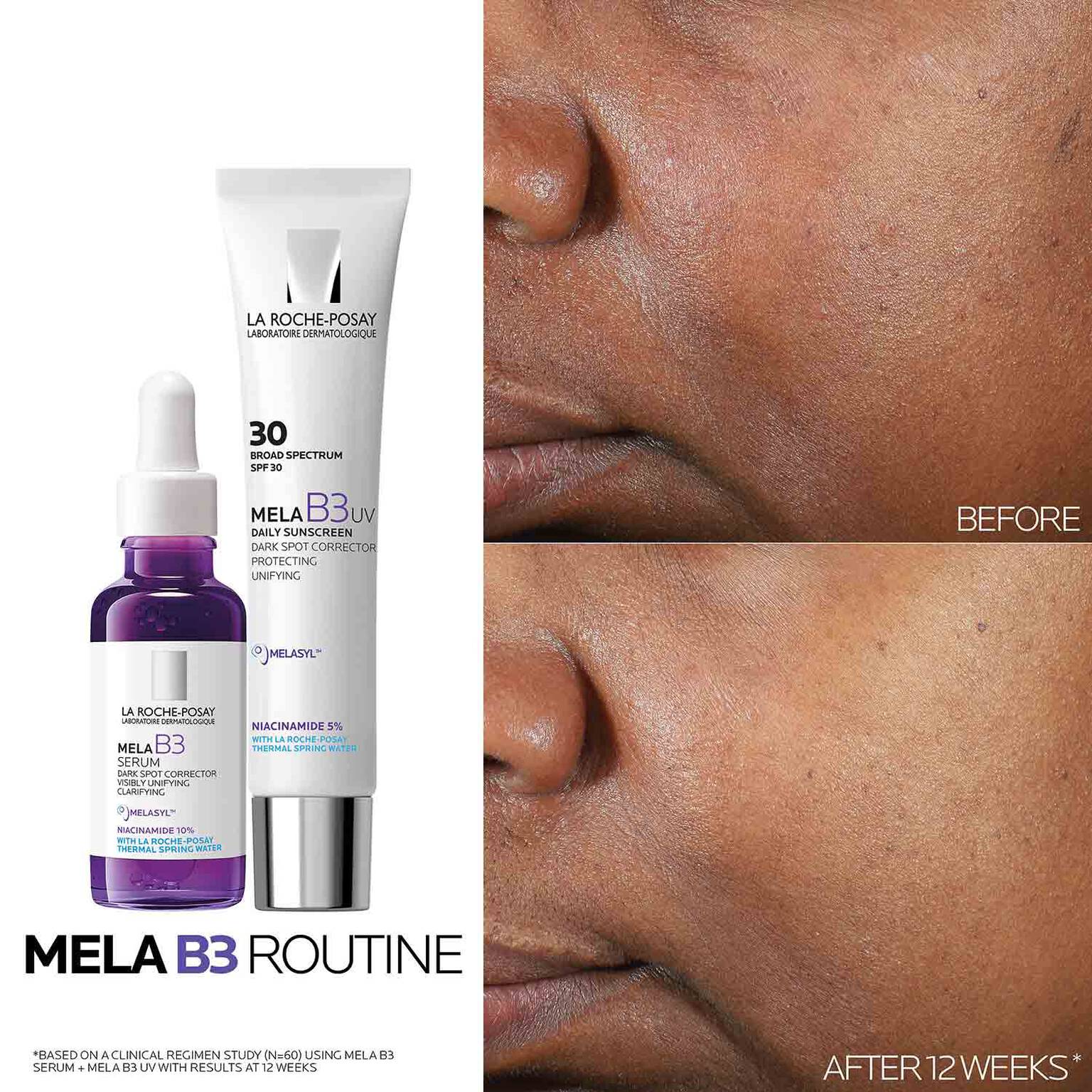 mela-b3-dark-spot-serum-with-melasyltm-niacinamide-g5 Mela-B3-routine_1500X1500.jpg
